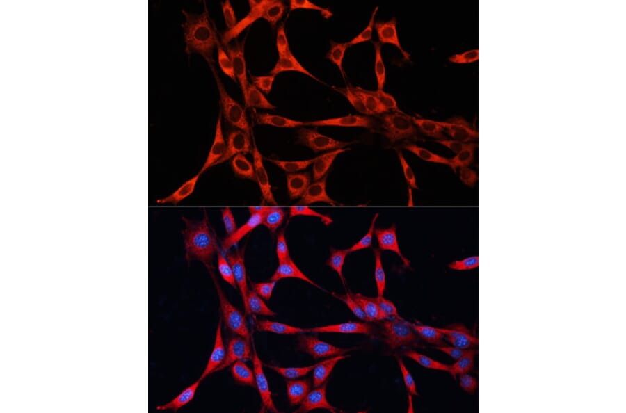 Immunofluorescence - Anti-mTOR Antibody (A13984) - Antibodies.com