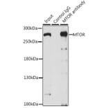 Western Blot - Anti-mTOR Antibody (A13984) - Antibodies.com