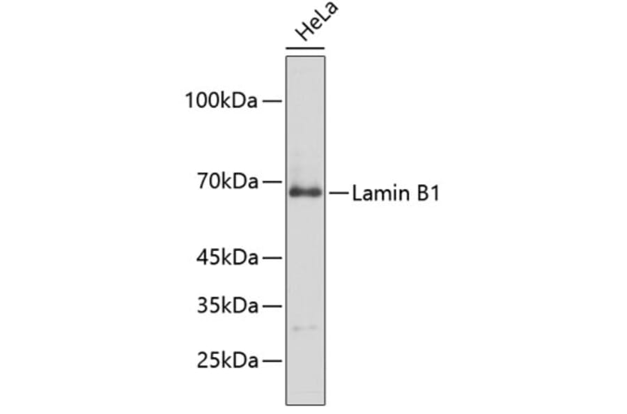 Western Blot - Anti-Lamin B1 Antibody (A13985) - Antibodies.com