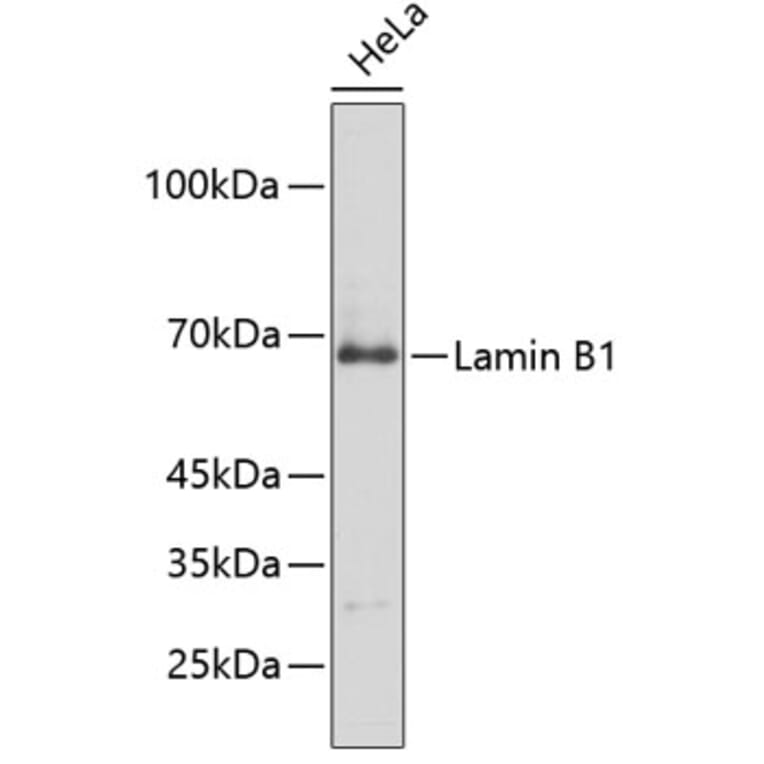 Western Blot - Anti-Lamin B1 Antibody (A13985) - Antibodies.com