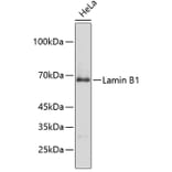 Western Blot - Anti-Lamin B1 Antibody (A13985) - Antibodies.com
