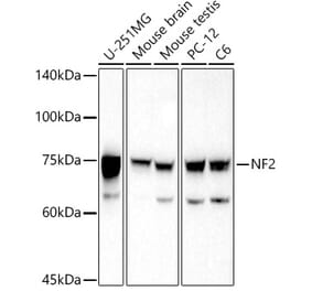 Western Blot - Anti-NF2 / Merlin Antibody (A13987) - Antibodies.com