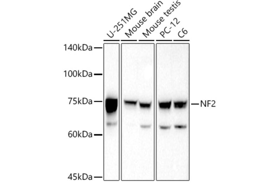 Western Blot - Anti-NF2 / Merlin Antibody (A13987) - Antibodies.com