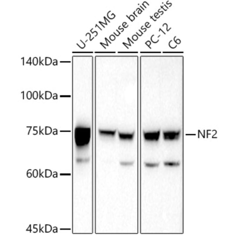 Western Blot - Anti-NF2 / Merlin Antibody (A13987) - Antibodies.com