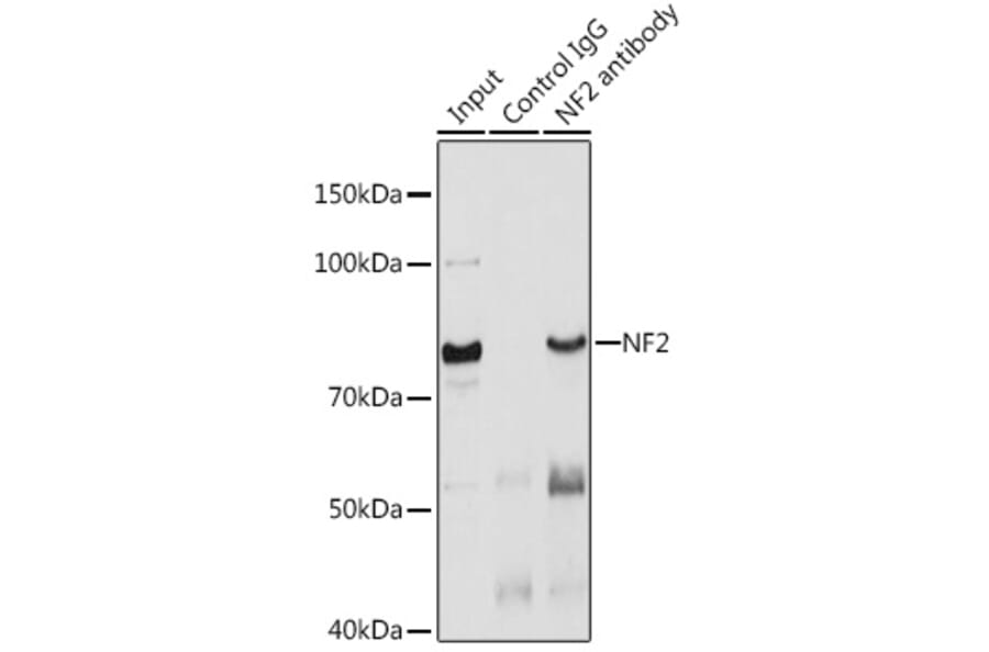 Western Blot - Anti-NF2 / Merlin Antibody (A13987) - Antibodies.com
