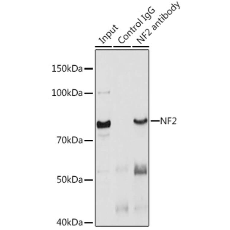 Western Blot - Anti-NF2 / Merlin Antibody (A13987) - Antibodies.com