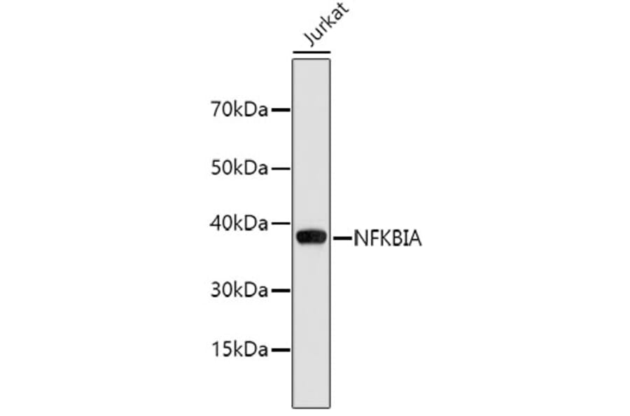Western Blot - Anti-NFKBIA Antibody (A2457) - Antibodies.com