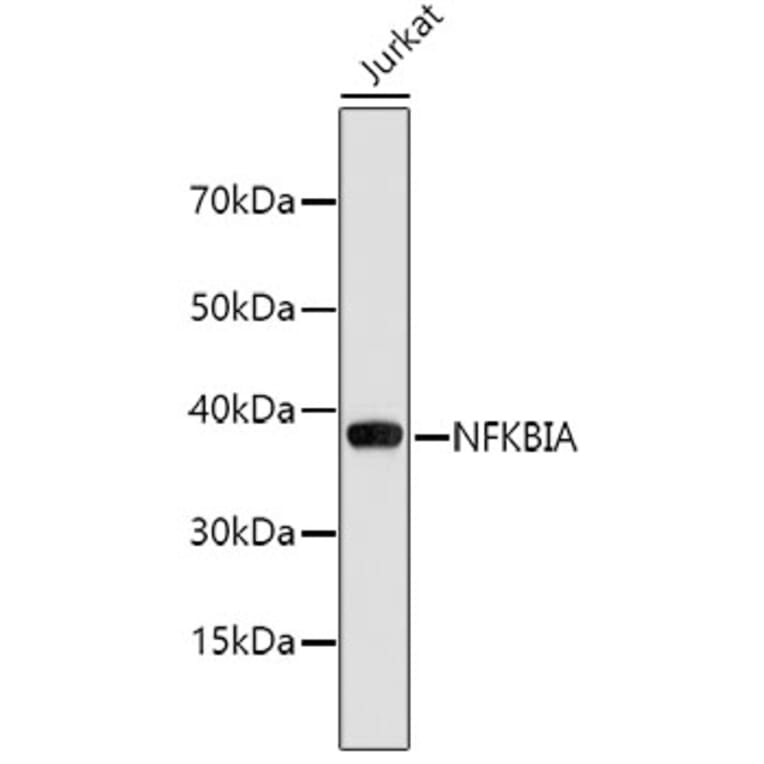 Western Blot - Anti-NFKBIA Antibody (A2457) - Antibodies.com