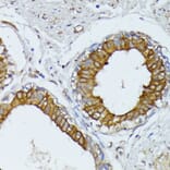 Immunohistochemistry - Anti-Wnt1 Antibody (A13992) - Antibodies.com