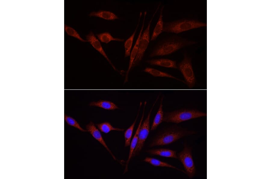 Immunofluorescence - Anti-Wnt1 Antibody (A13992) - Antibodies.com