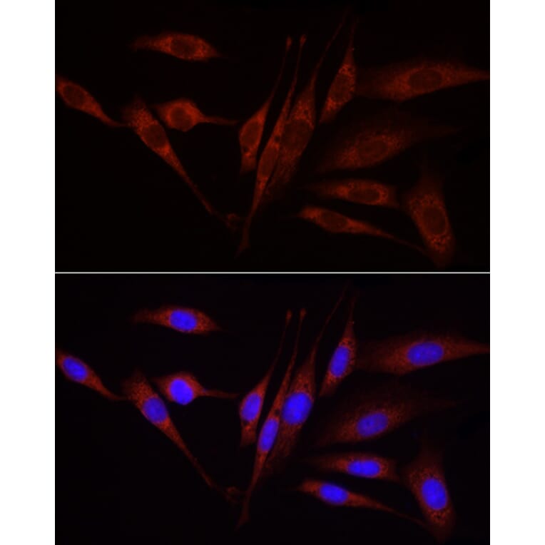 Immunofluorescence - Anti-Wnt1 Antibody (A13992) - Antibodies.com