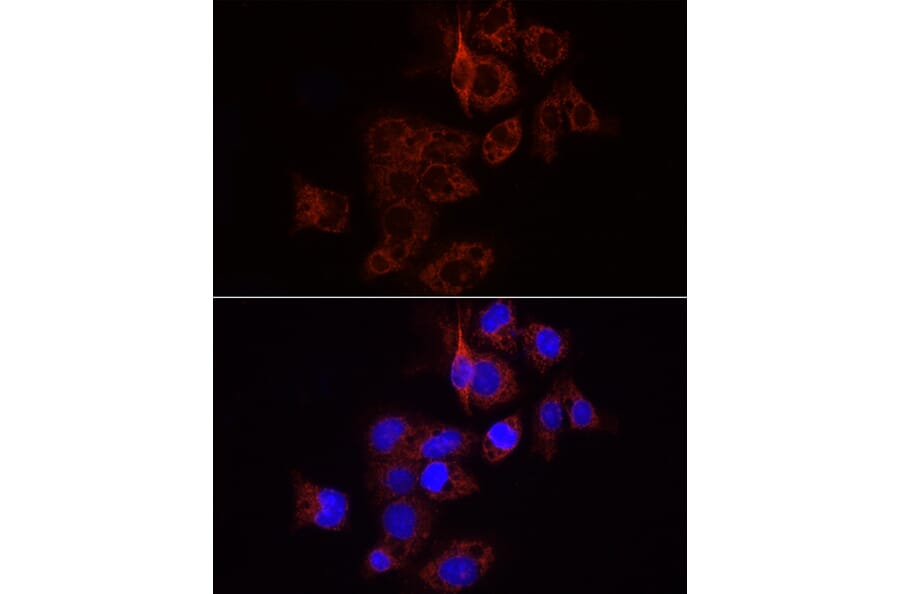 Immunofluorescence - Anti-Wnt1 Antibody (A13992) - Antibodies.com