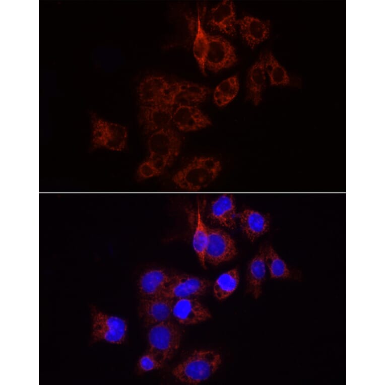 Immunofluorescence - Anti-Wnt1 Antibody (A13992) - Antibodies.com