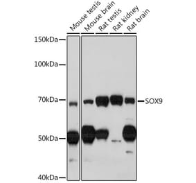 Western Blot - Anti-SOX9 Antibody (A13994) - Antibodies.com