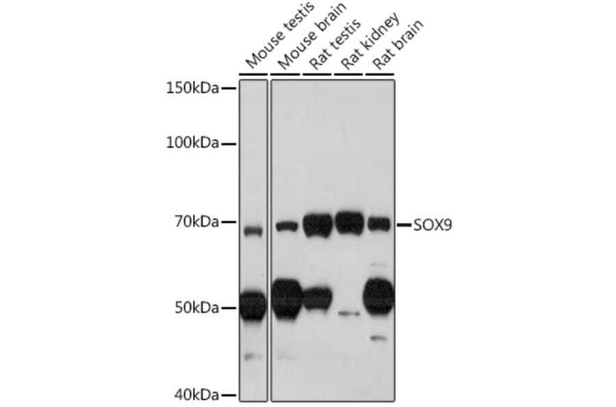 Western Blot - Anti-SOX9 Antibody (A13994) - Antibodies.com