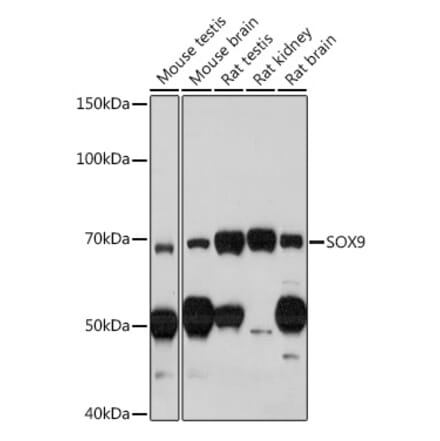 Western Blot - Anti-SOX9 Antibody (A13994) - Antibodies.com