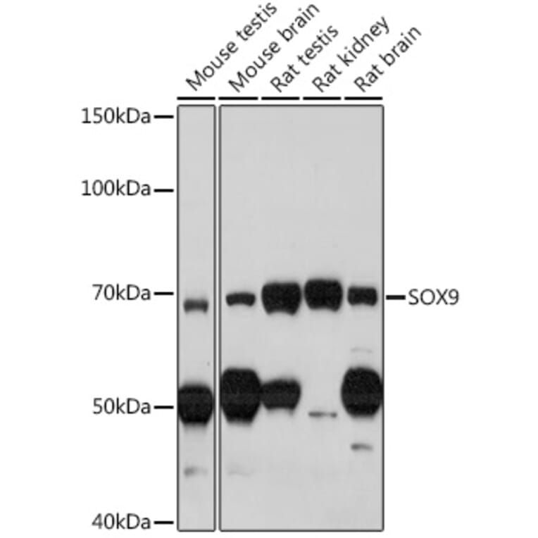 Western Blot - Anti-SOX9 Antibody (A13994) - Antibodies.com