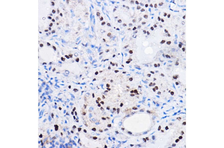 Immunohistochemistry - Anti-SOX9 Antibody (A13994) - Antibodies.com