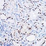 Immunohistochemistry - Anti-SOX9 Antibody (A13994) - Antibodies.com