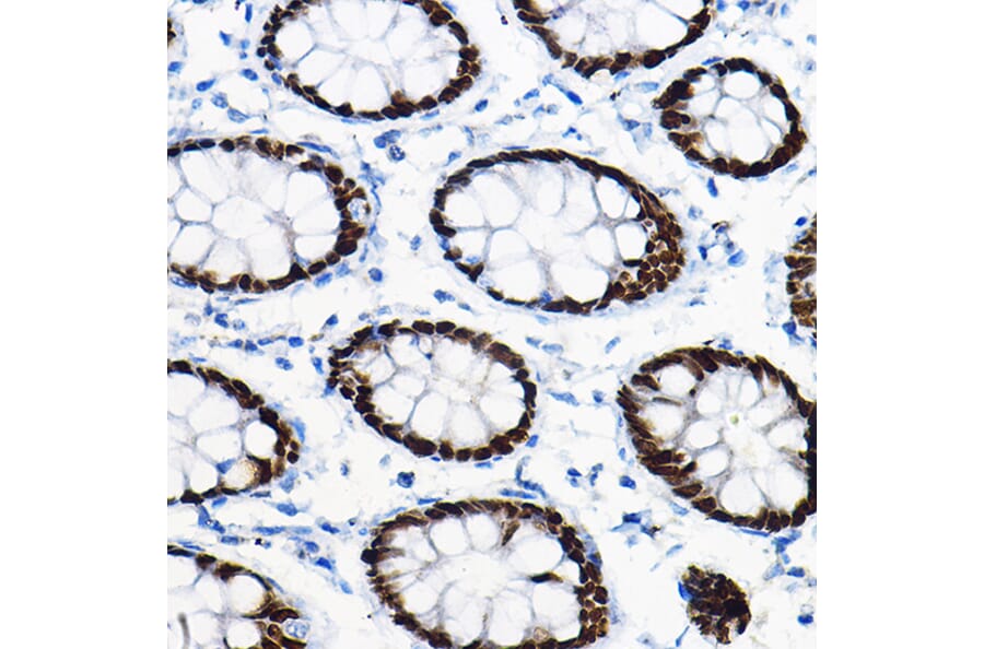 Immunohistochemistry - Anti-SOX9 Antibody (A13994) - Antibodies.com