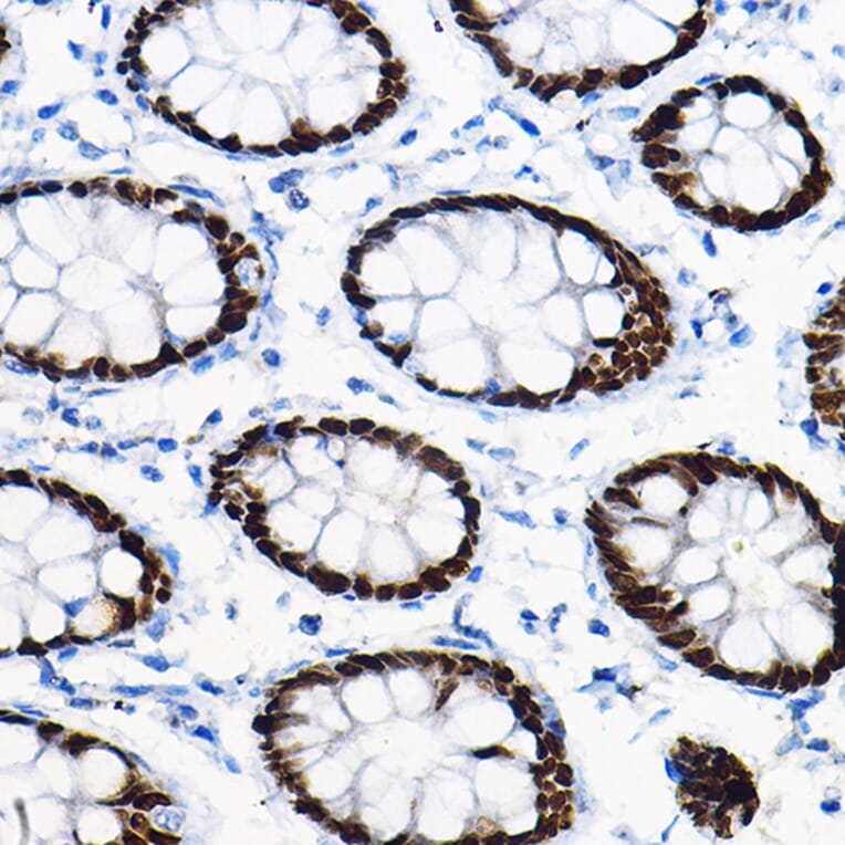 Immunohistochemistry - Anti-SOX9 Antibody (A13994) - Antibodies.com
