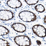 Immunohistochemistry - Anti-SOX9 Antibody (A13994) - Antibodies.com