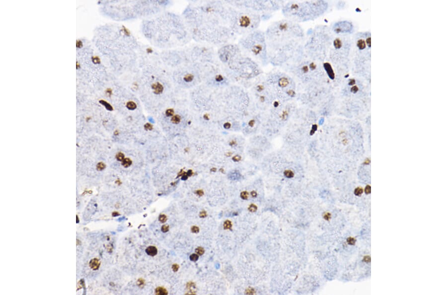 Immunohistochemistry - Anti-SOX9 Antibody (A13994) - Antibodies.com