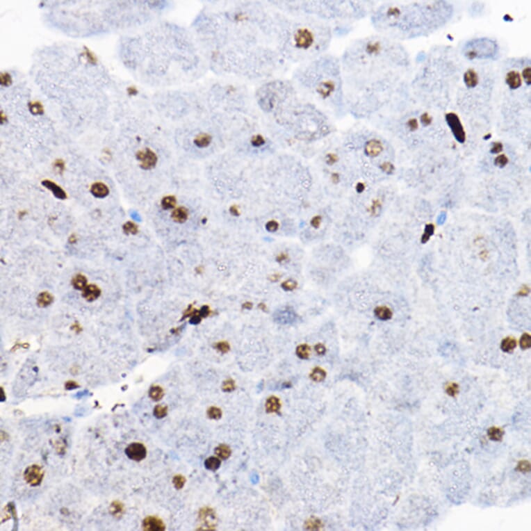 Immunohistochemistry - Anti-SOX9 Antibody (A13994) - Antibodies.com