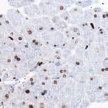 Immunohistochemistry - Anti-SOX9 Antibody (A13994) - Antibodies.com