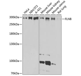 Western Blot - Anti-Filamin B Antibody (A13995) - Antibodies.com