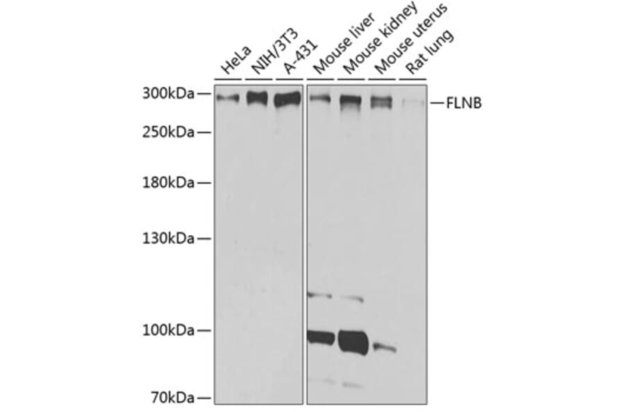 Western Blot - Anti-Filamin B Antibody (A13995) - Antibodies.com