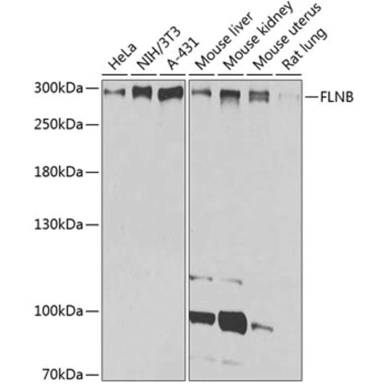 Western Blot - Anti-Filamin B Antibody (A13995) - Antibodies.com