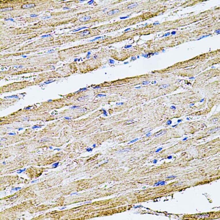 Immunohistochemistry - Anti-Filamin B Antibody (A13995) - Antibodies.com