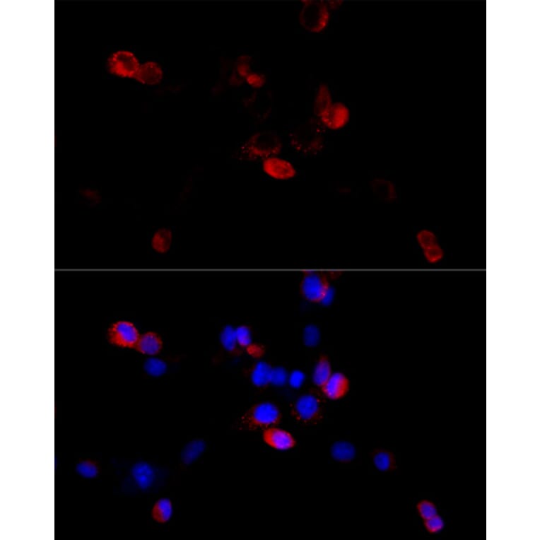 Immunofluorescence - Anti-Filamin B Antibody (A13995) - Antibodies.com