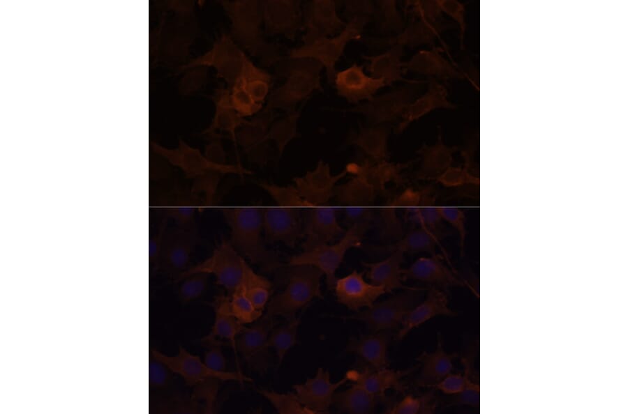Immunofluorescence - Anti-Filamin B Antibody (A13995) - Antibodies.com