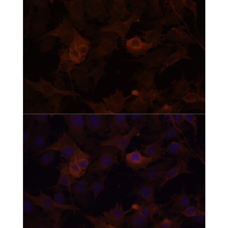 Immunofluorescence - Anti-Filamin B Antibody (A13995) - Antibodies.com