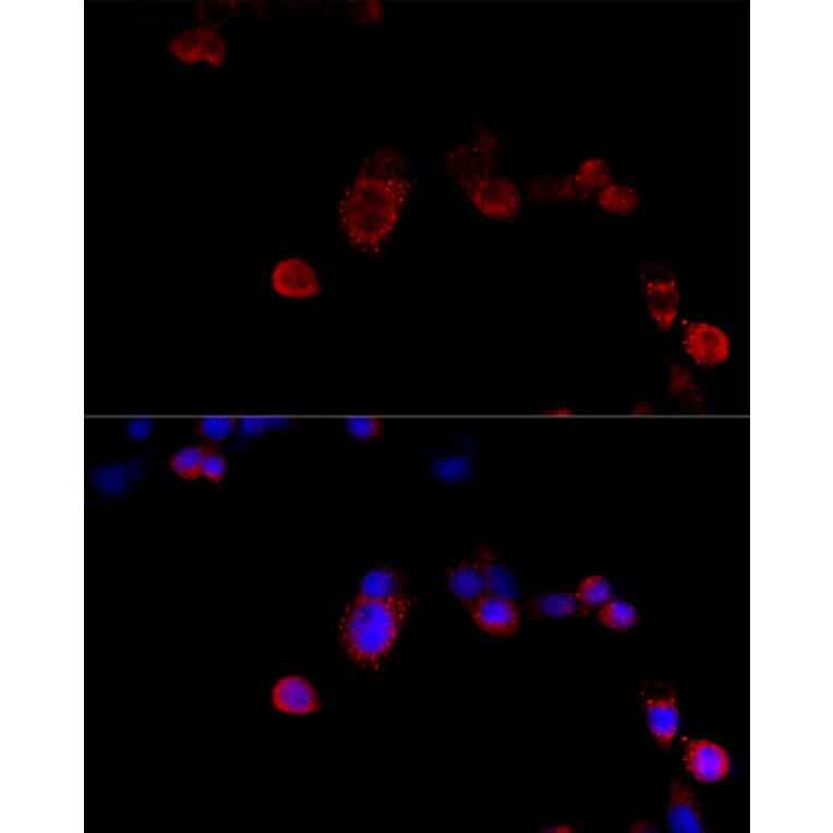 Immunofluorescence - Anti-Filamin B Antibody (A13995) - Antibodies.com