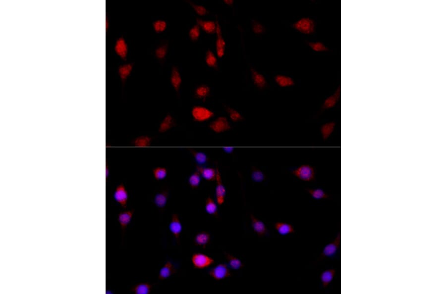 Immunofluorescence - Anti-Filamin B Antibody (A13995) - Antibodies.com