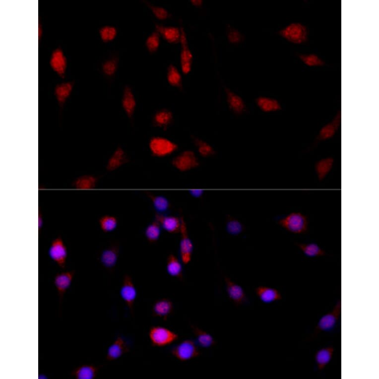 Immunofluorescence - Anti-Filamin B Antibody (A13995) - Antibodies.com