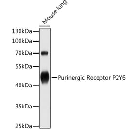 Western Blot - Anti-P2Y6 Antibody (A13999) - Antibodies.com