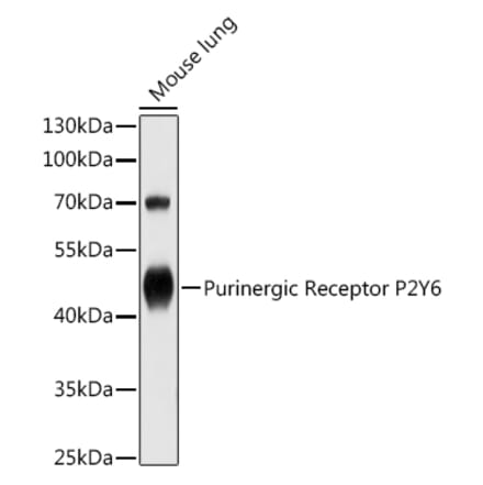 Western Blot - Anti-P2Y6 Antibody (A13999) - Antibodies.com