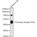 Western Blot - Anti-P2Y6 Antibody (A13999) - Antibodies.com