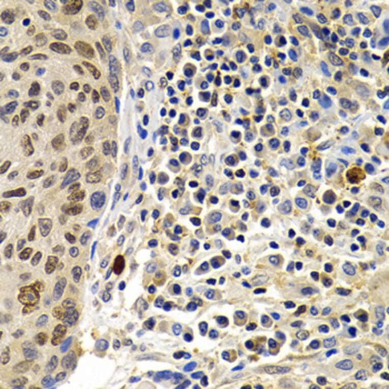 Immunohistochemistry - Anti-SUMO2 Antibody (A2486) - Antibodies.com