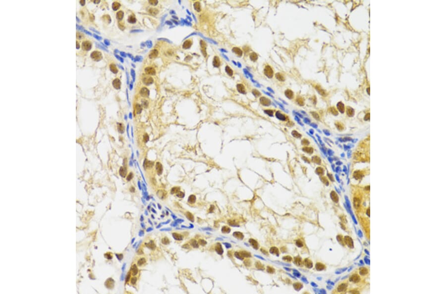 Immunohistochemistry - Anti-SUMO2 Antibody (A2486) - Antibodies.com