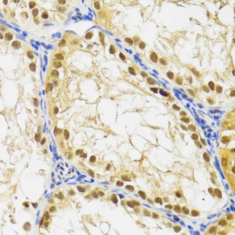 Immunohistochemistry - Anti-SUMO2 Antibody (A2486) - Antibodies.com