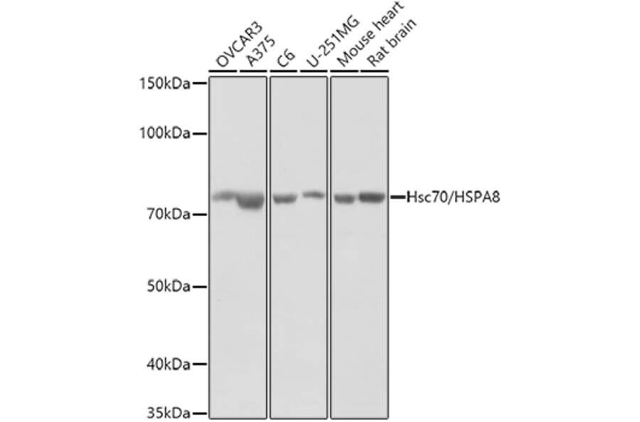 Western Blot - Anti-Hsc70 Antibody (A14001) - Antibodies.com