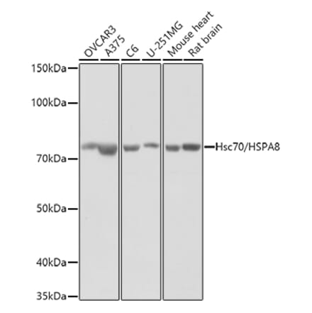 Western Blot - Anti-Hsc70 Antibody (A14001) - Antibodies.com