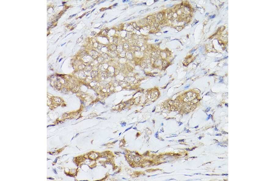 Immunohistochemistry - Anti-Hsc70 Antibody (A14001) - Antibodies.com