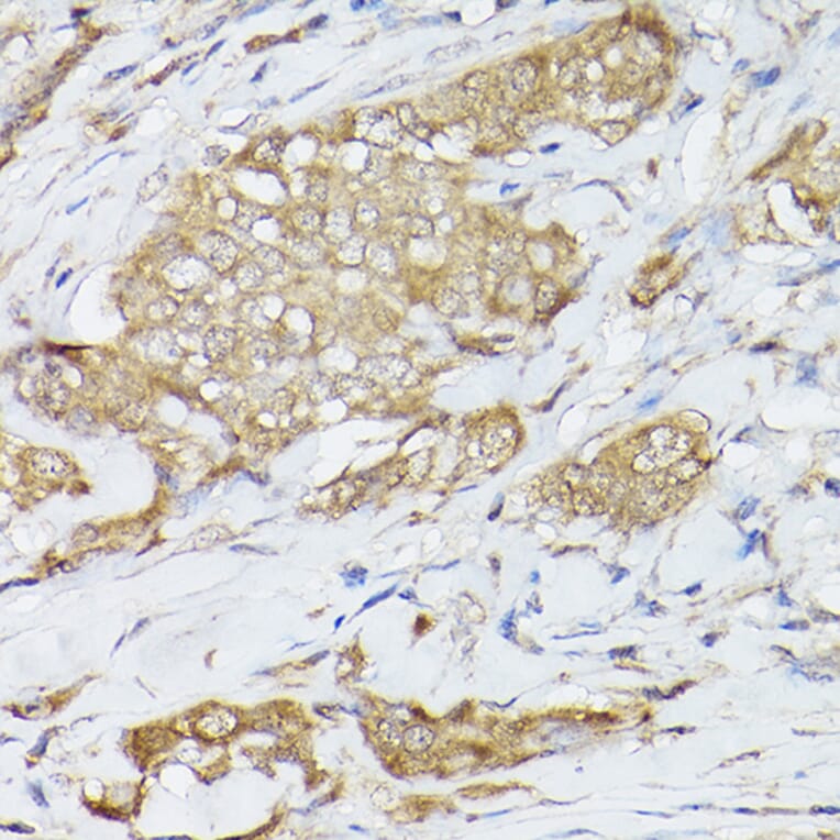 Immunohistochemistry - Anti-Hsc70 Antibody (A14001) - Antibodies.com