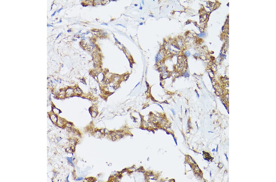 Immunohistochemistry - Anti-Hsc70 Antibody (A14001) - Antibodies.com
